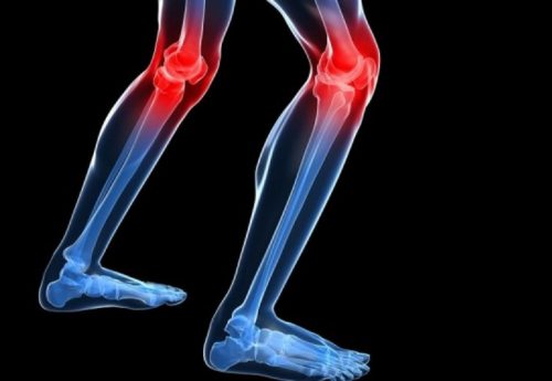 Arthralgien und Myalgien